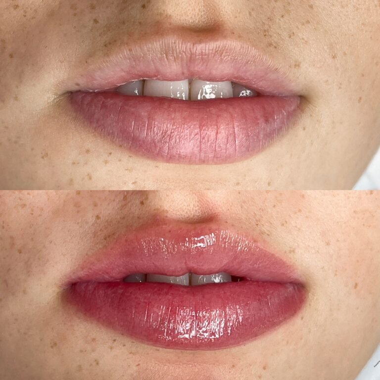 Flow Lips
